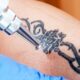 Tattoo Removal Timeline